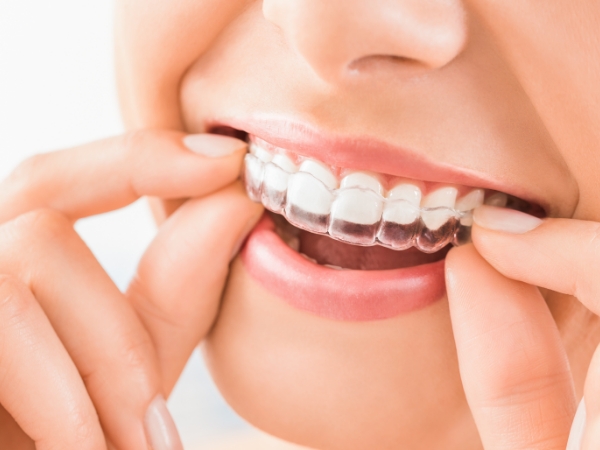 Invisalign in hand